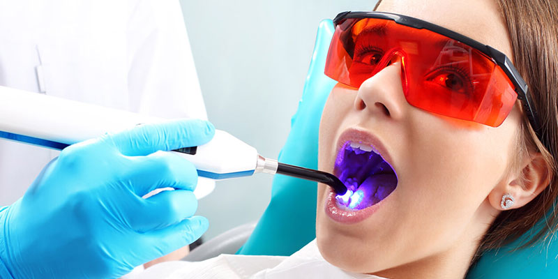 Zahnbehandlungen mit Laserapplikation